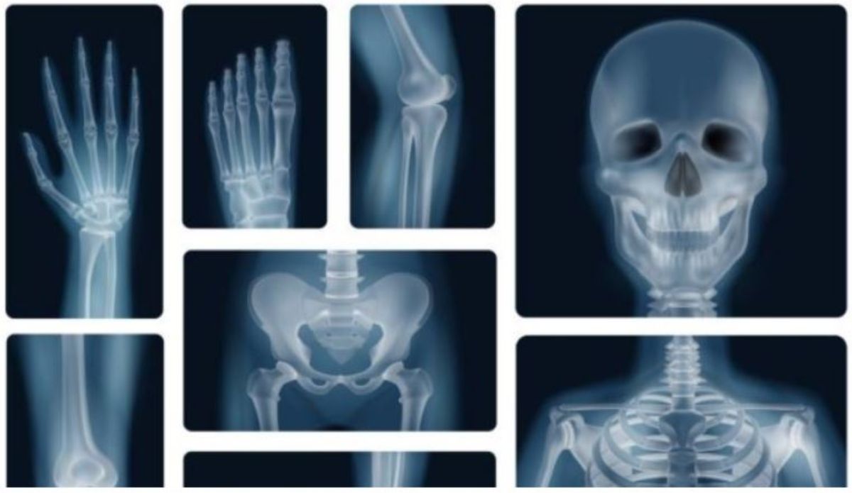 5 من الآثار الجانبية لخل التفاح لإنقاص الوزن.. مؤكد أنك لم تتوقع حدوثها ) 5 من الآثار الجانبية لخل التفاح لإنقاص الوزن.. مؤكد أنك لم تتوقع حدوثها