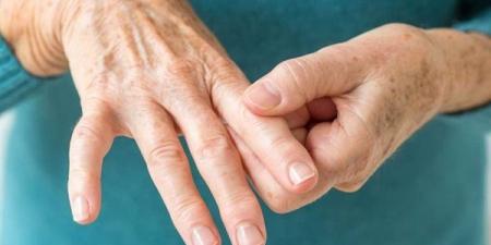 أعراض الروماتويد وأسباب الإصابة به وطرق العلاج