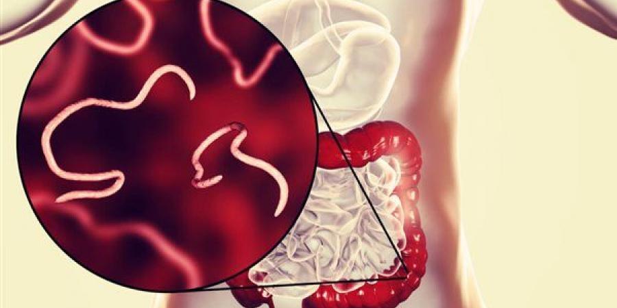 مشروبات طبيعية تساعد في علاج الديدان المعوية