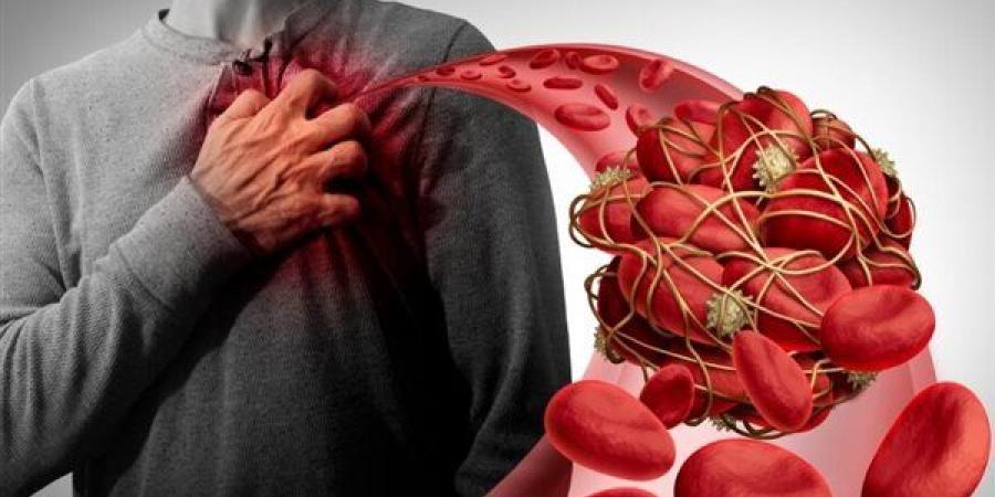 استشاري قلب يحذر: المتعافون من كورونا أكثر عرضة للإصابة بالجلطات
